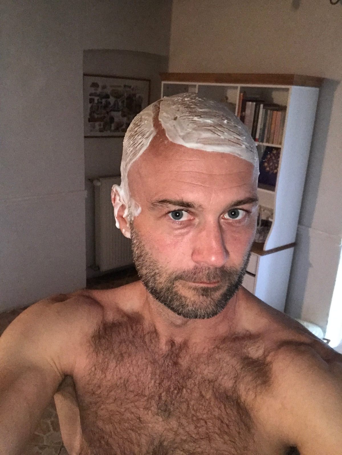 Hair Loss in Men: Is It Really Just Genetics?